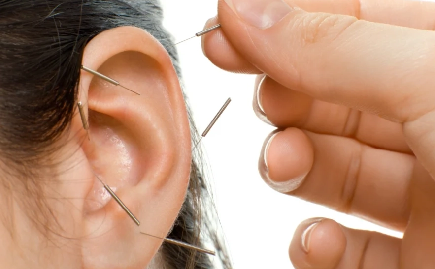 耳鳴中醫經驗 耳鳴中醫經驗