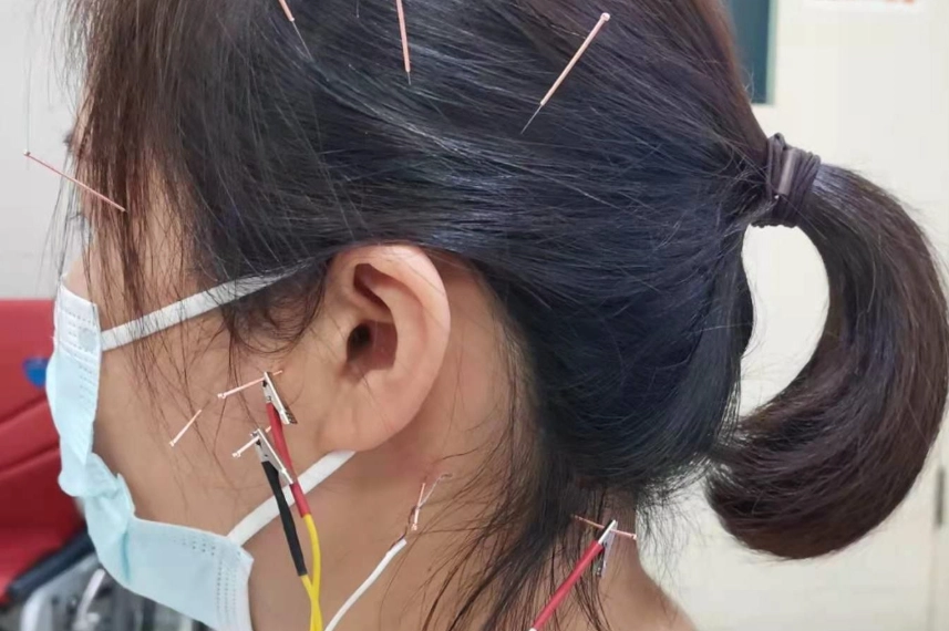 耳鳴治療副作用