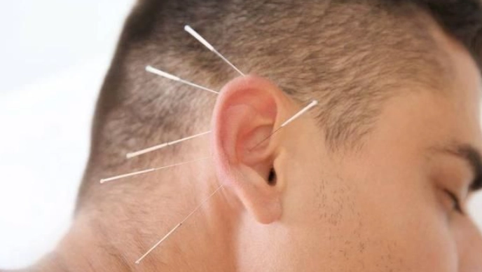 中醫耳鳴治療 中醫耳鳴治療