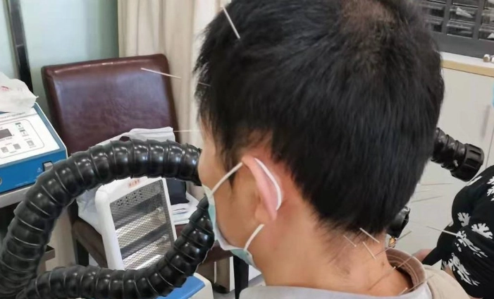 中醫耳鳴治療 中醫耳鳴治療