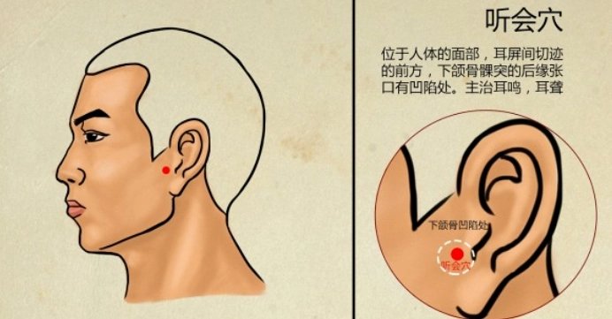 耳鳴中醫經驗 耳鳴中醫經驗