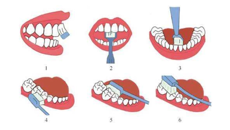 牙齦流血怎麼辦 牙齦流血怎麼辦