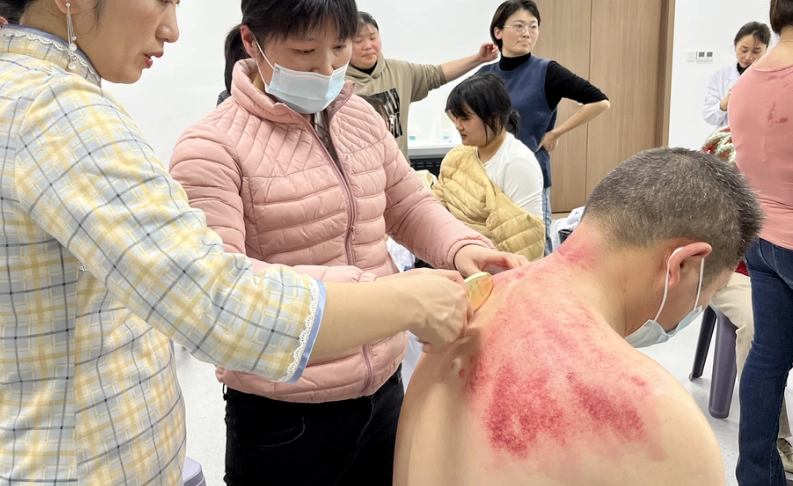 刮痧部位 刮痧部位