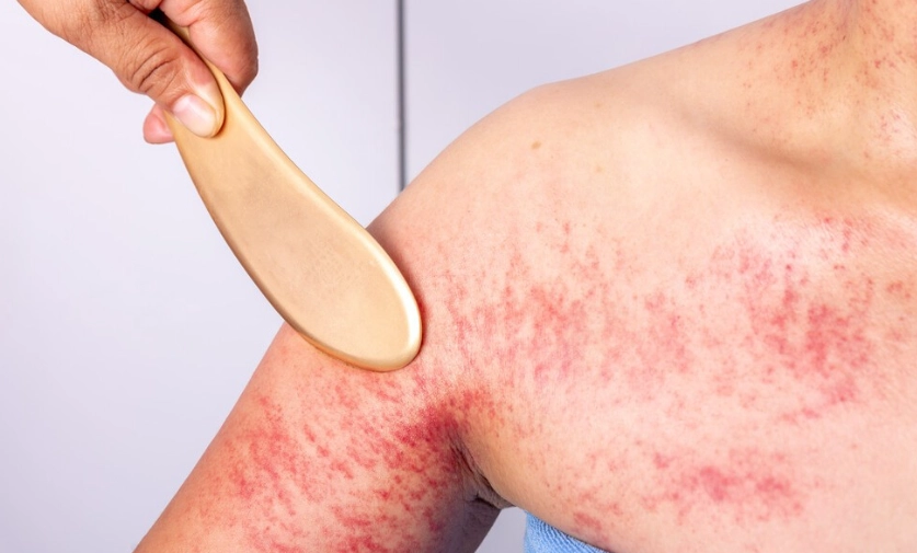 刮痧部位 刮痧部位