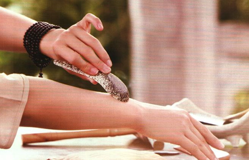 刮痧治療中暑 刮痧治療中暑