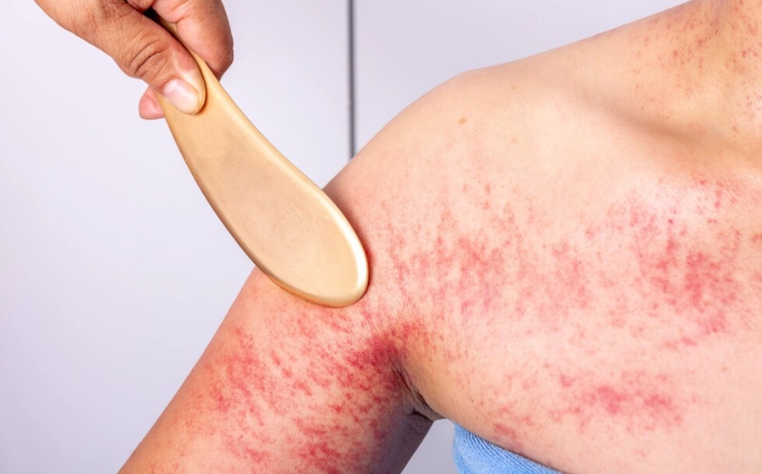 刮痧禁忌 刮痧禁忌