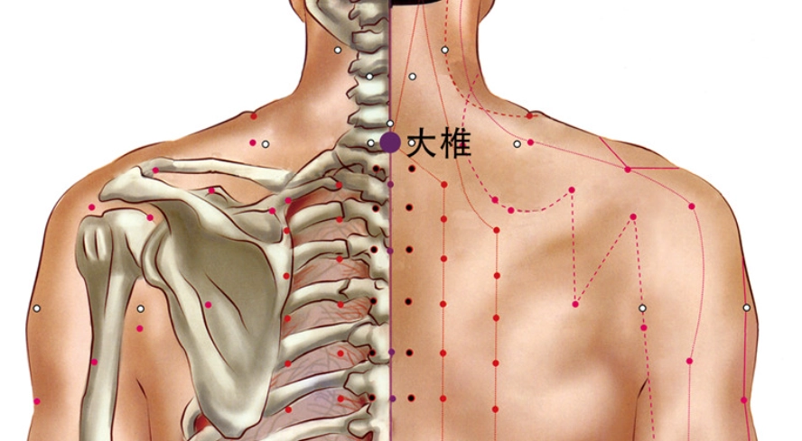 刮痧治療中暑 刮痧治療中暑
