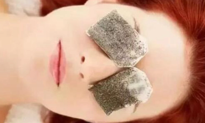 眼袋治療 眼袋治療