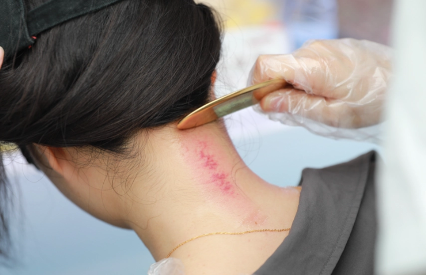 中暑急救穴位 中暑急救穴位