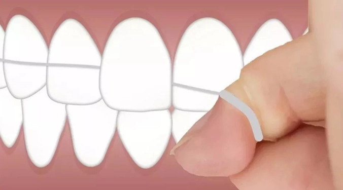 口腔清潔步驟 口腔清潔步驟