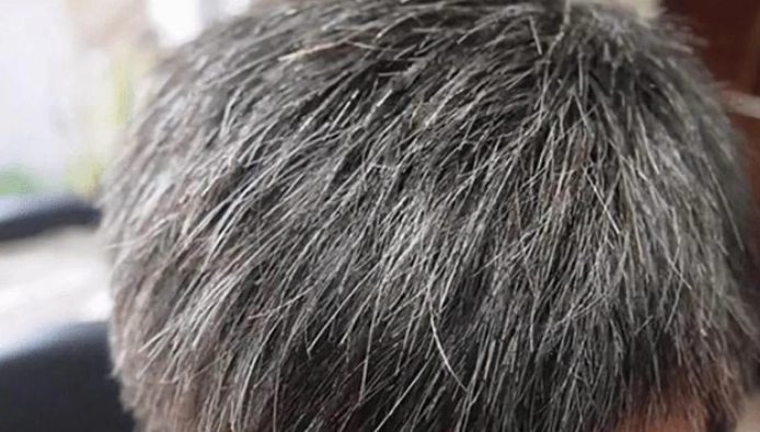 一天長幾根頭髮 一天長幾根頭髮