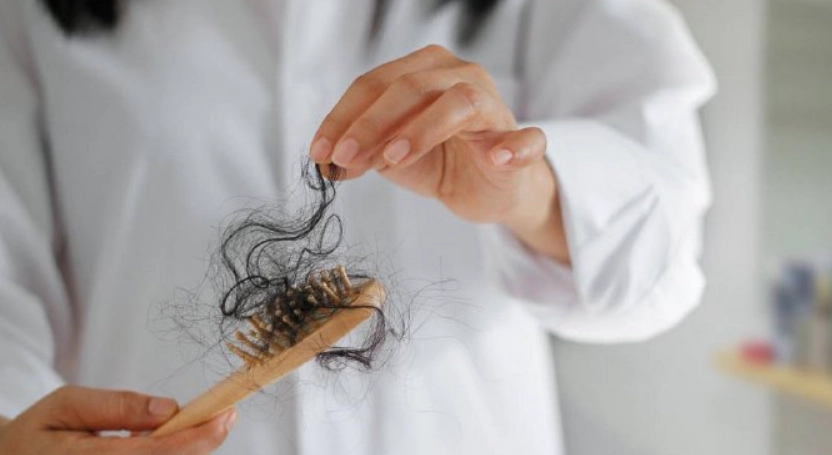 女性掉髮原因 女性掉髮原因