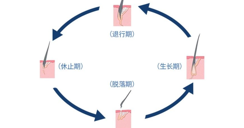 禿頭預防護理 禿頭預防護理
