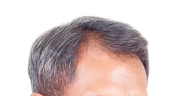 頭髮健康 頭髮健康