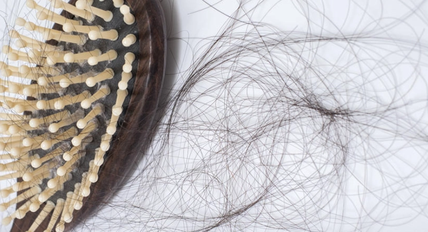掉髮原因 掉髮原因