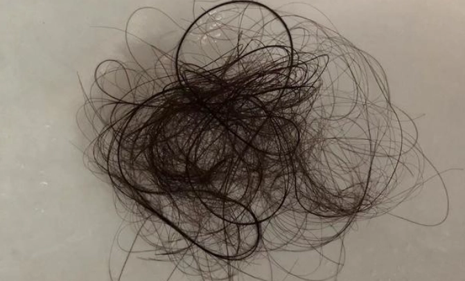 掉髮原因 掉髮原因