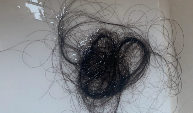 掉髮原因 掉髮原因