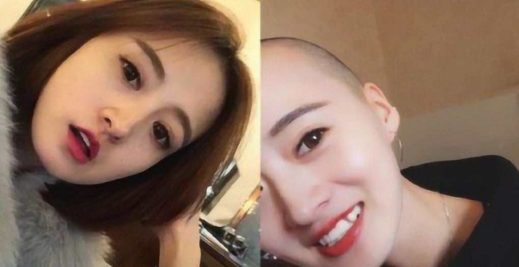 頭髮健康 頭髮健康