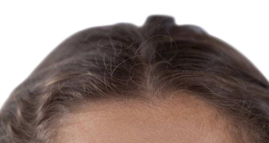 頭髮扁塌改善 頭髮扁塌改善