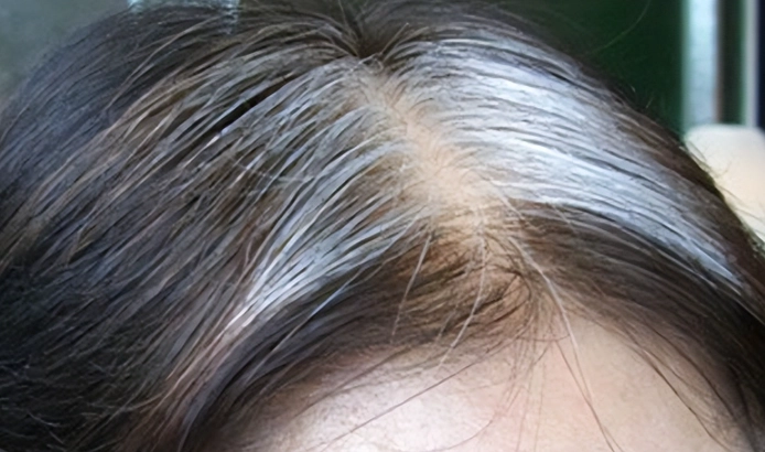 白頭髮如何變黑 白頭髮如何變黑