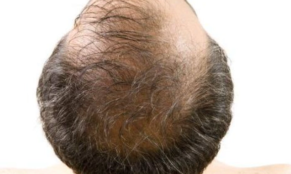 髮量少髮型 髮量少髮型