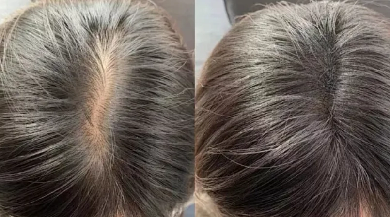 髮量少髮型 髮量少髮型