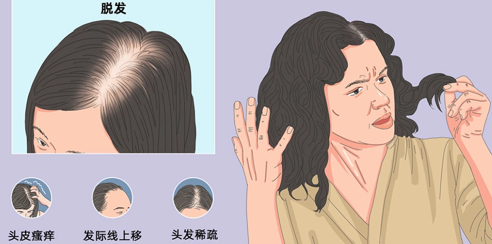 全身毛髮脫落原因 全身毛髮脫落原因