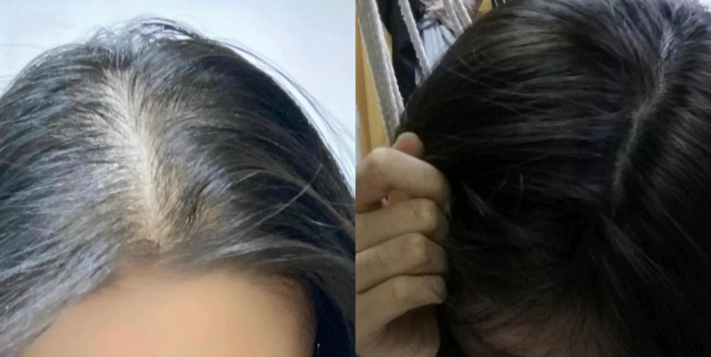 髮量少改善 髮量少改善